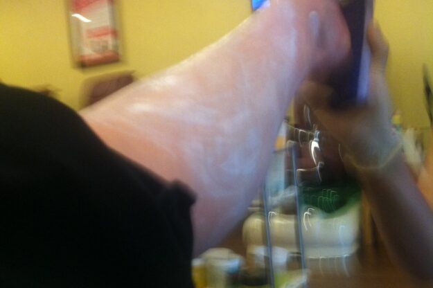 blog-L-pedicure–e1406006144351